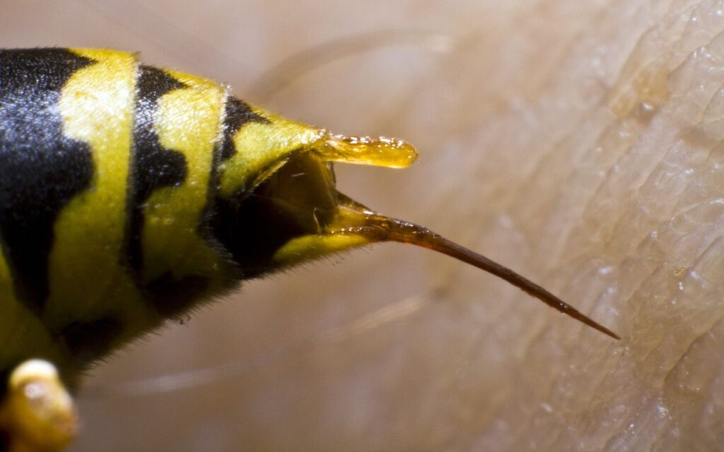 Wasp Sting Vs Bee Sting